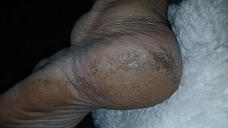 Antes rachaduras, ressecamento